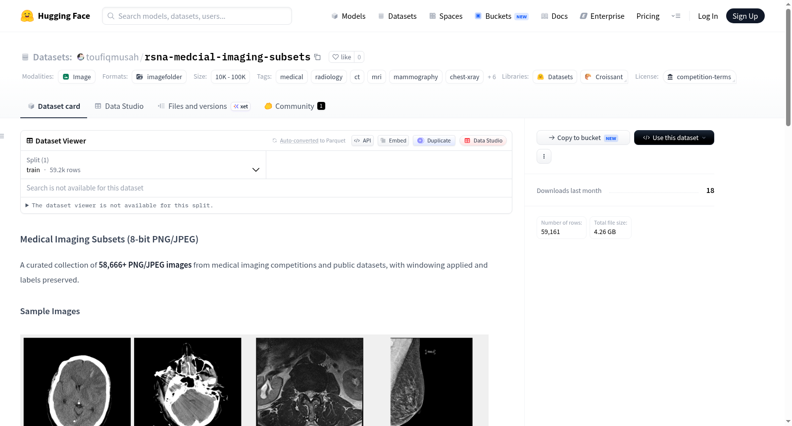 rsna-medcial-imaging-subsets 数据集图片