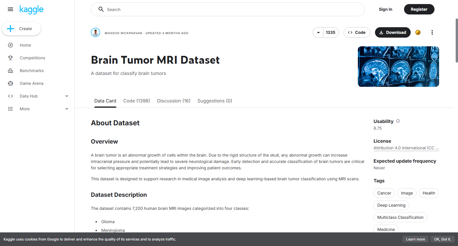 Brain Tumor MRI Dataset (with Pituitary tumor class)