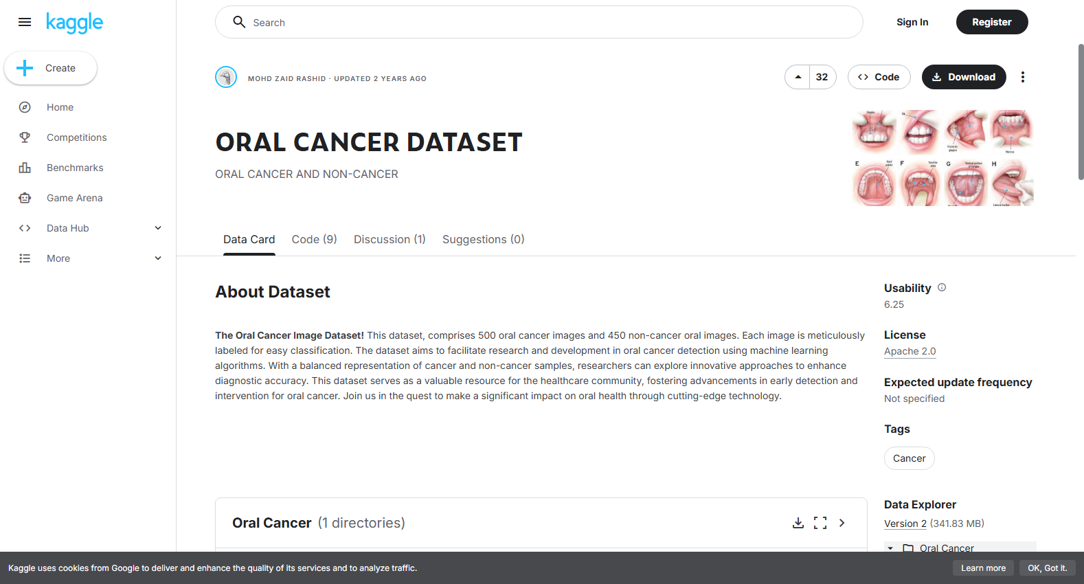 ORAL CANCER DATASET