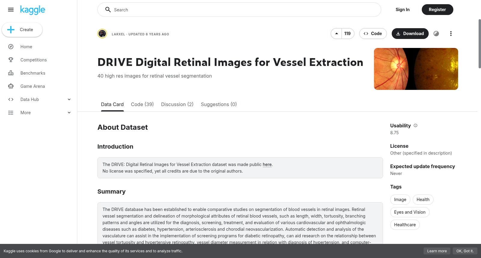 DRIVE Digital Retinal Images for Vessel Extraction 数据集图片