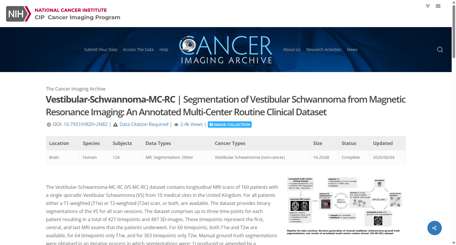 VESTIBULAR-SCHWANNOMA-MC-RC