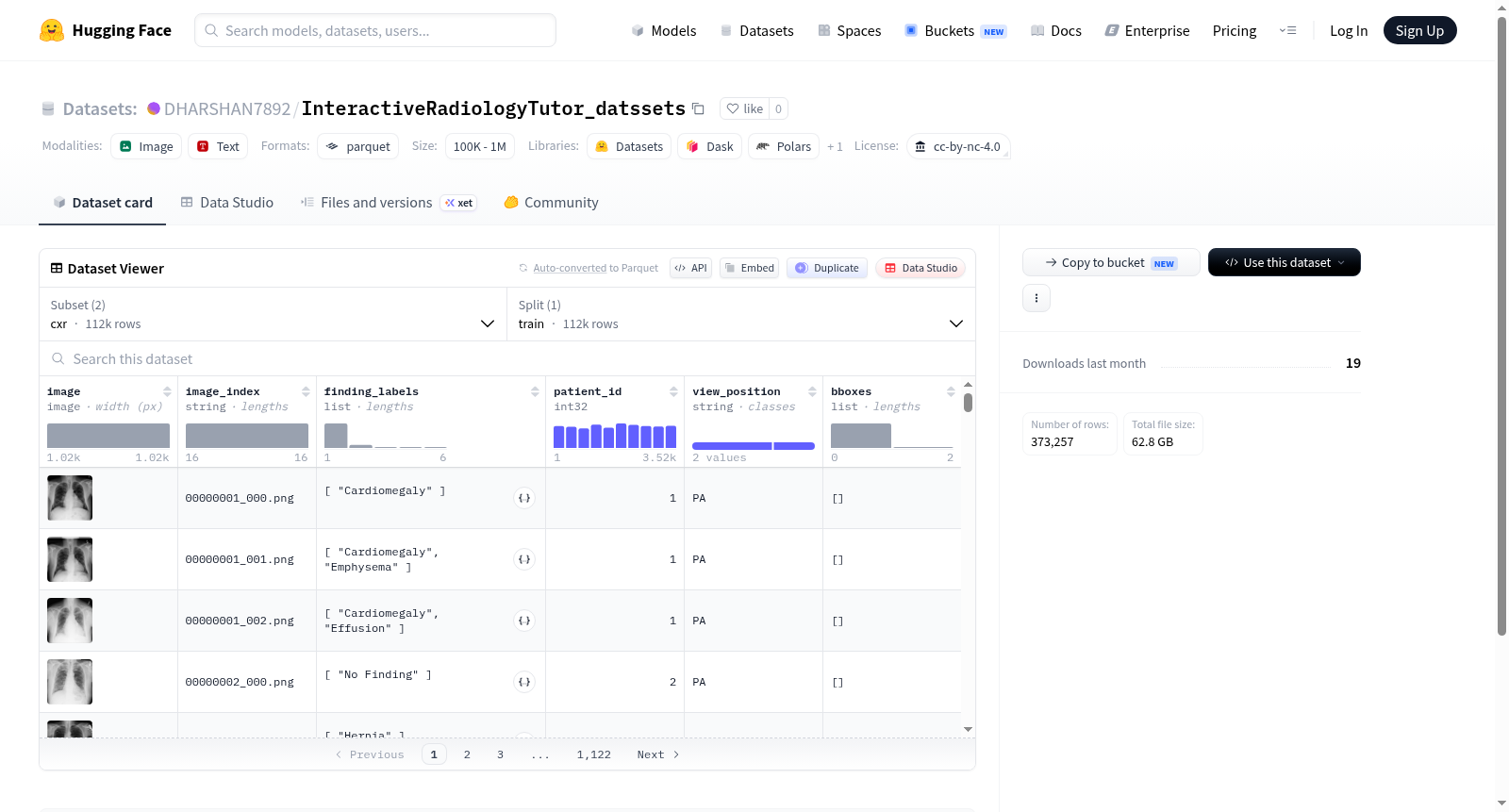 InteractiveRadiologyTutor_datssets 数据集图片