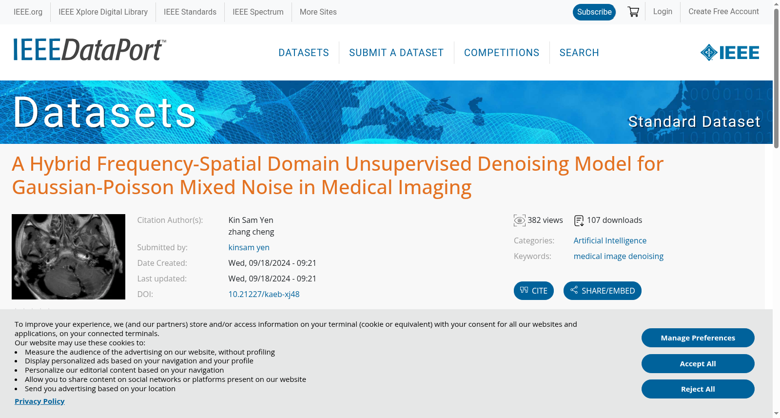 A Hybrid Frequency-Spatial Domain Unsupervised Denoising Model for Gaussian-Poisson Mixed Noise in Medical Imaging 数据集图片