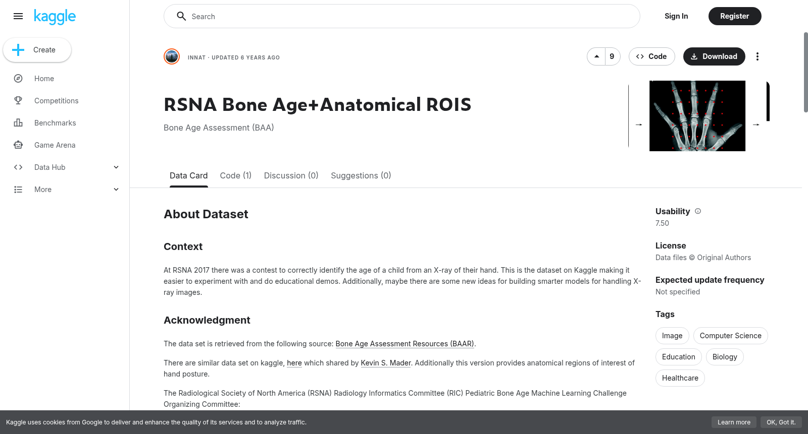 RSNA Bone Age+Anatomical ROIS 数据集图片
