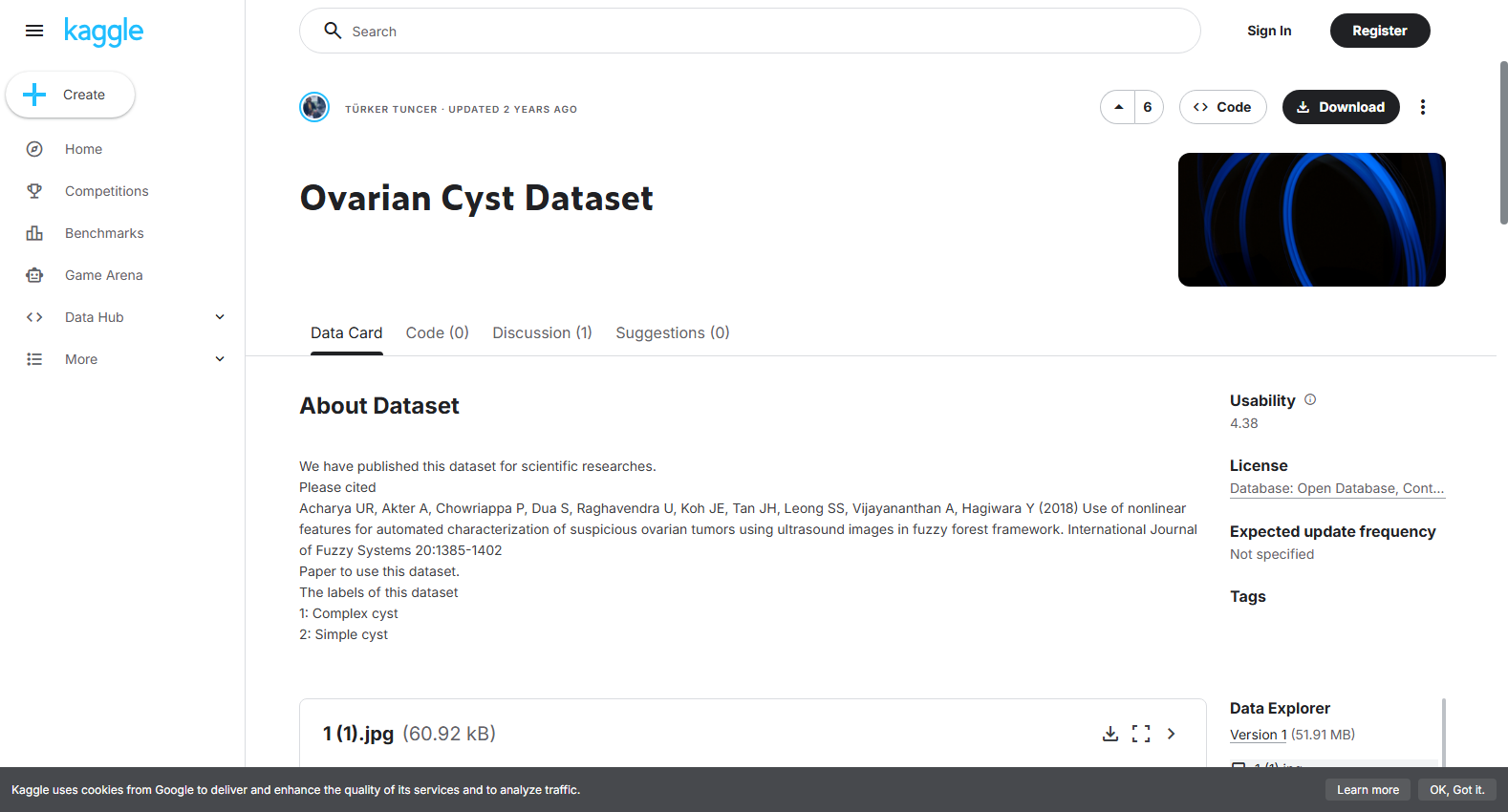 Ovarian Cyst Dataset