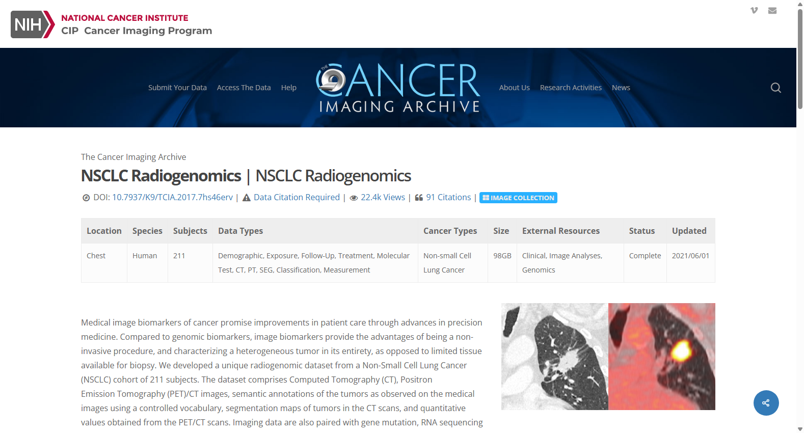 NSCLC-Radiogenomics