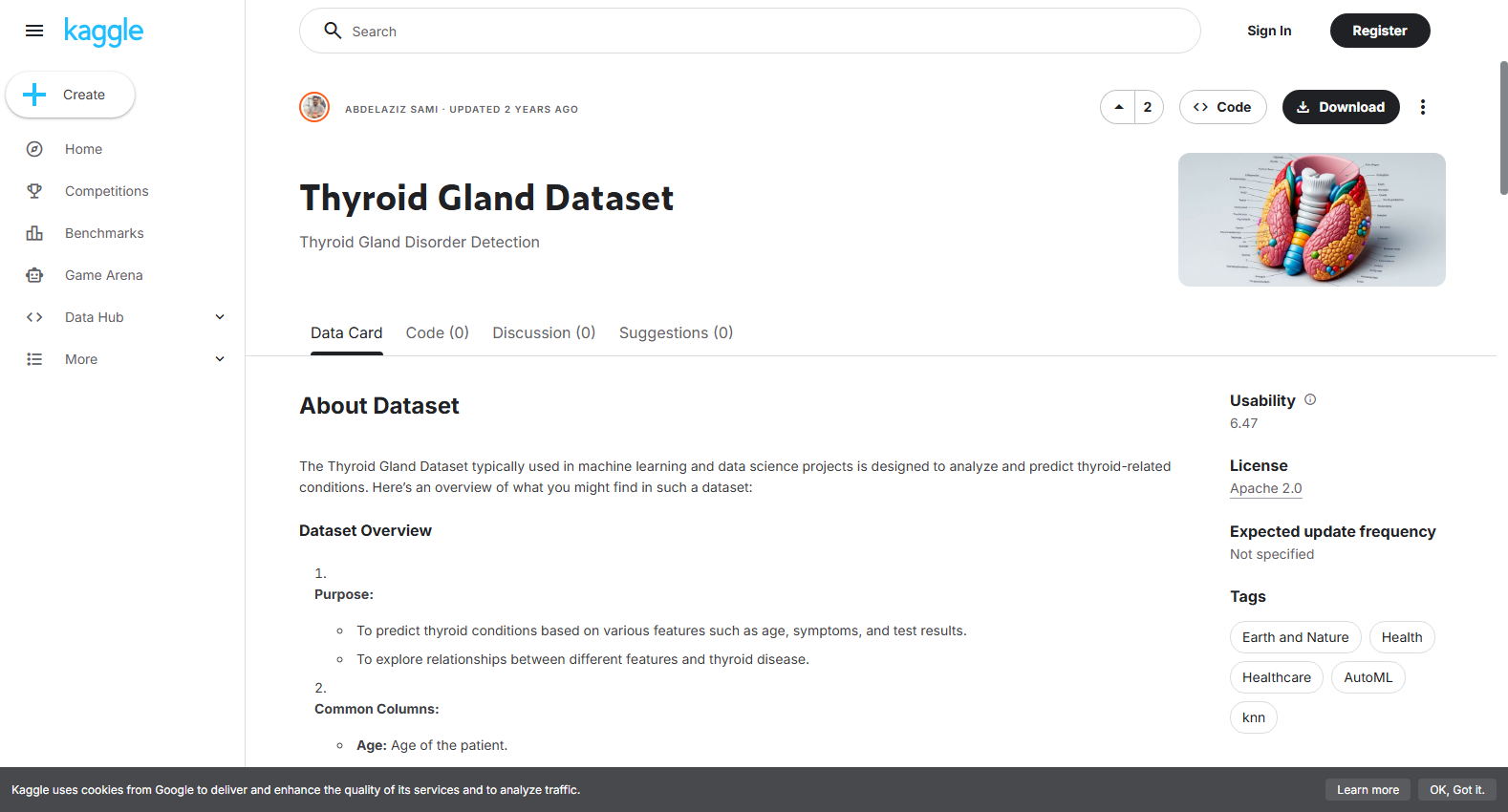 Thyroid Disease Dataset (with Hypopituitary features)