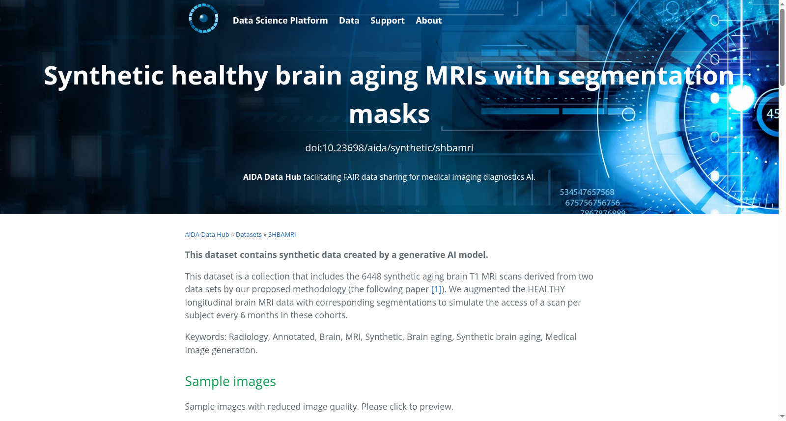 Synthetic healthy brain aging MRIs with segmentation masks 数据集图片