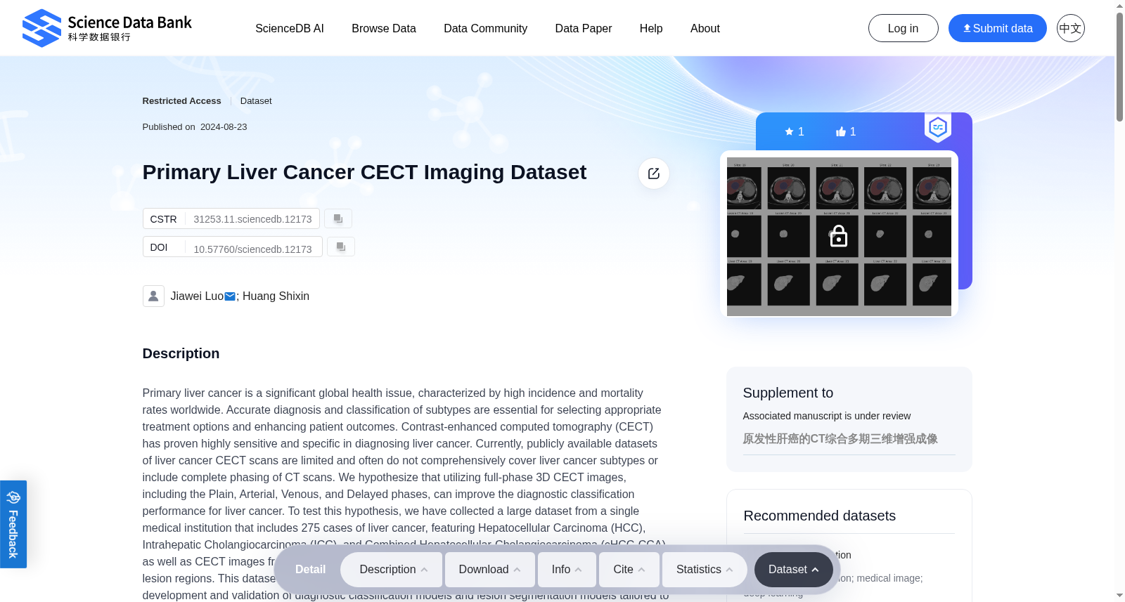 Primary Liver Cancer CECT Imaging Dataset 数据集图片