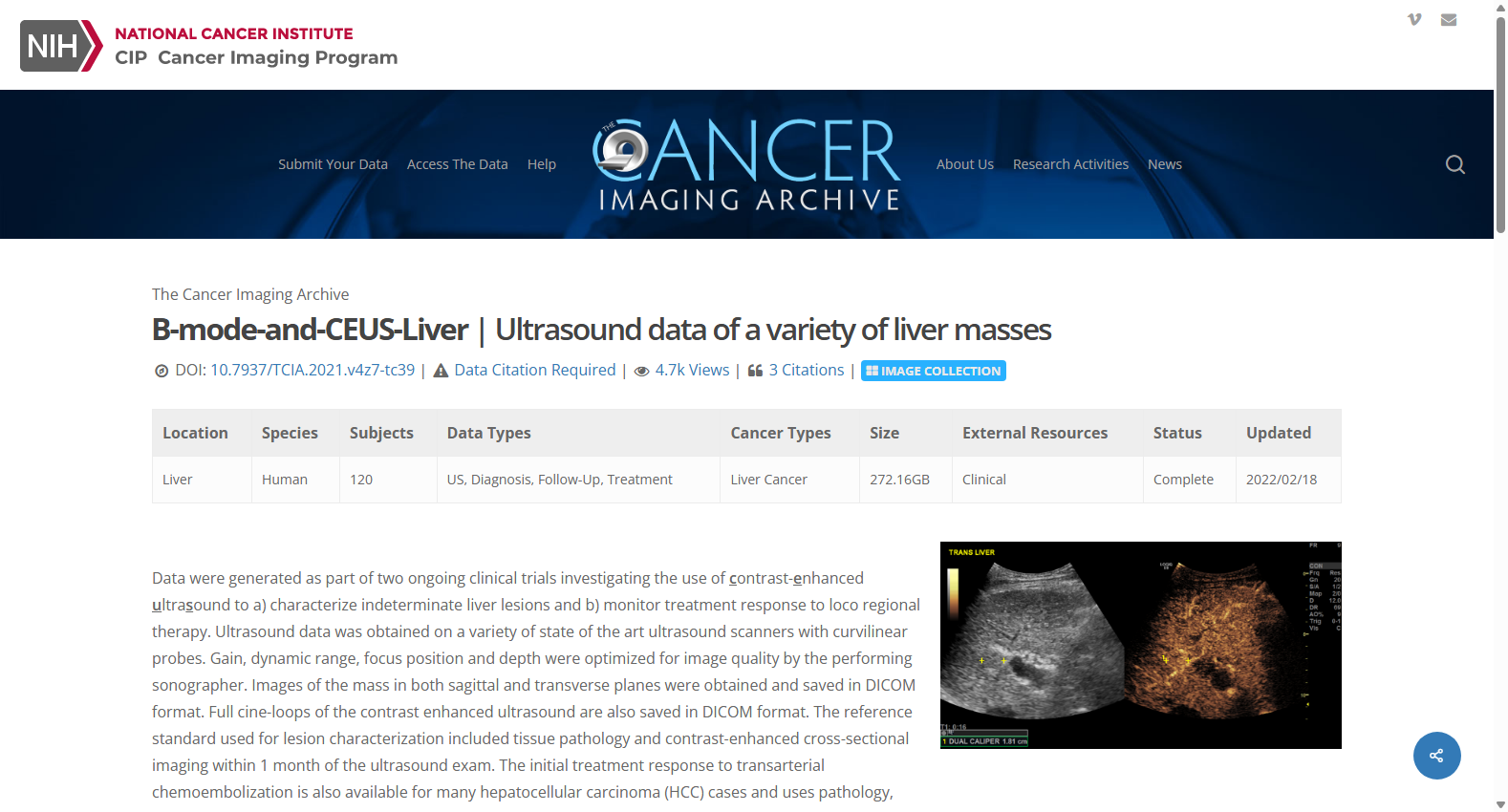 B-mode-and-CEUS-Liver