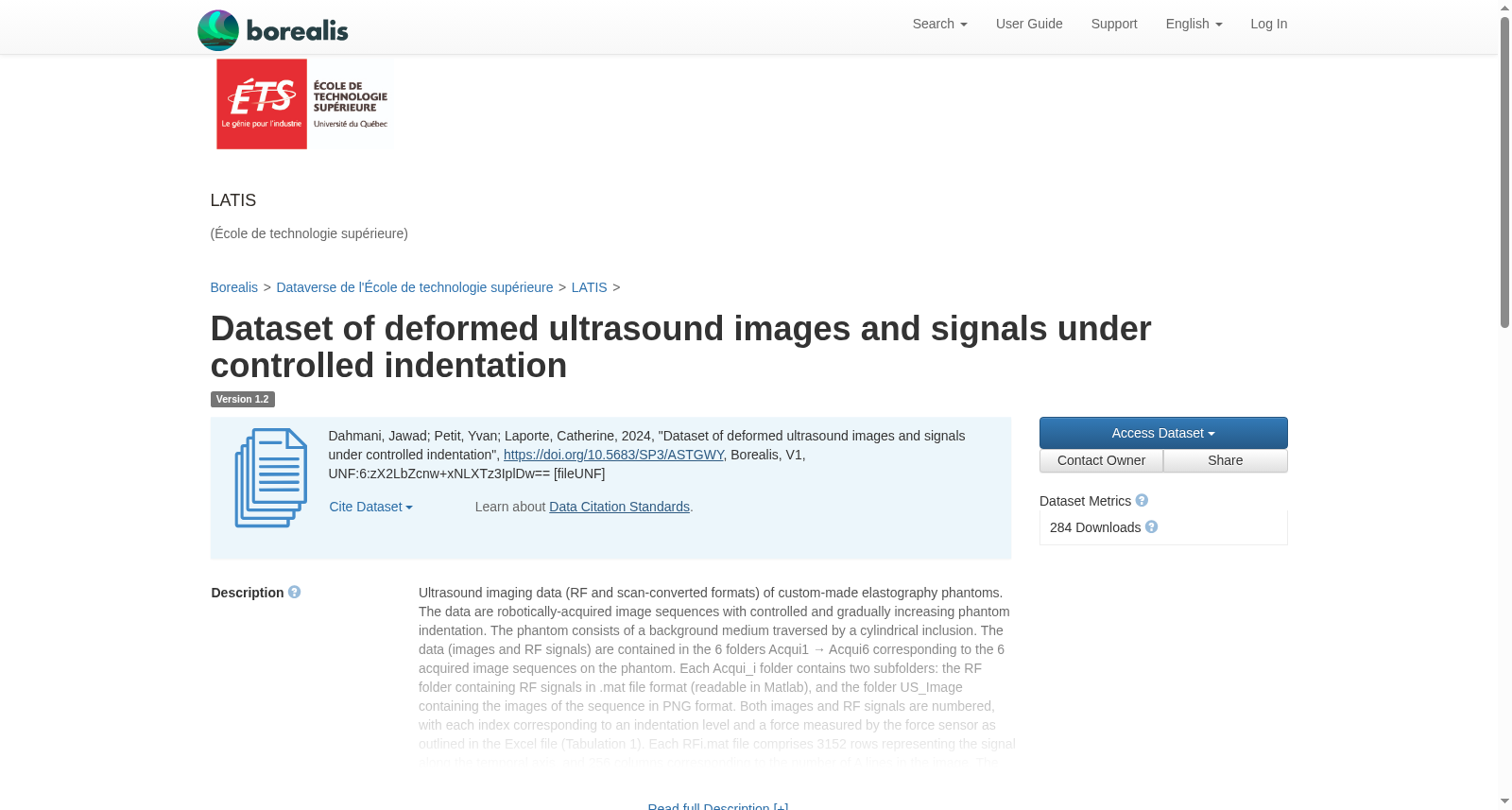Dataset of deformed ultrasound images and signals under controlled indentation 数据集图片