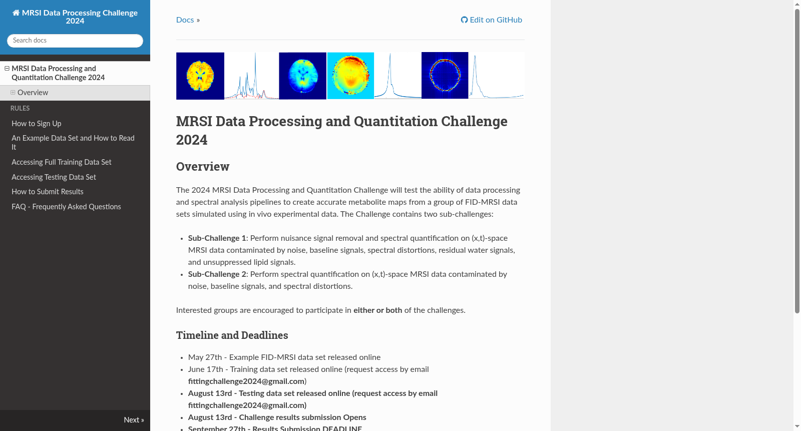 2024 MRSI Data Processing and Quantification Challenge Synthetic Dataset 数据集图片