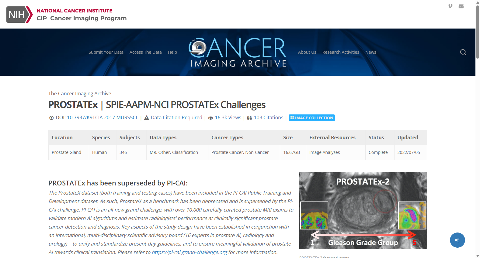 PROSTATEx