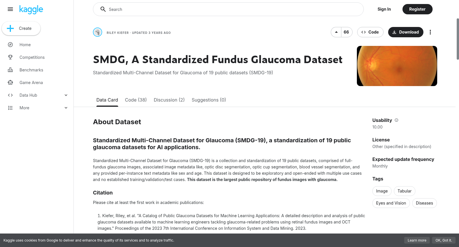 SMDG, A Standardized Fundus Glaucoma Dataset 数据集图片