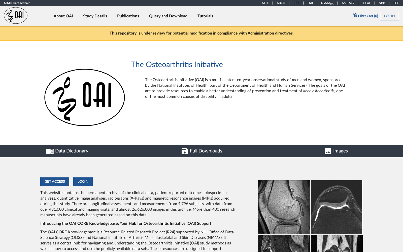 Osteoarthritis Initiative 数据集图片