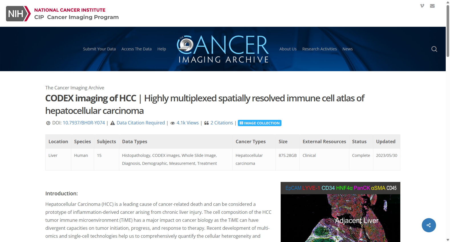 CODEX-IMAGING-OF-HCC