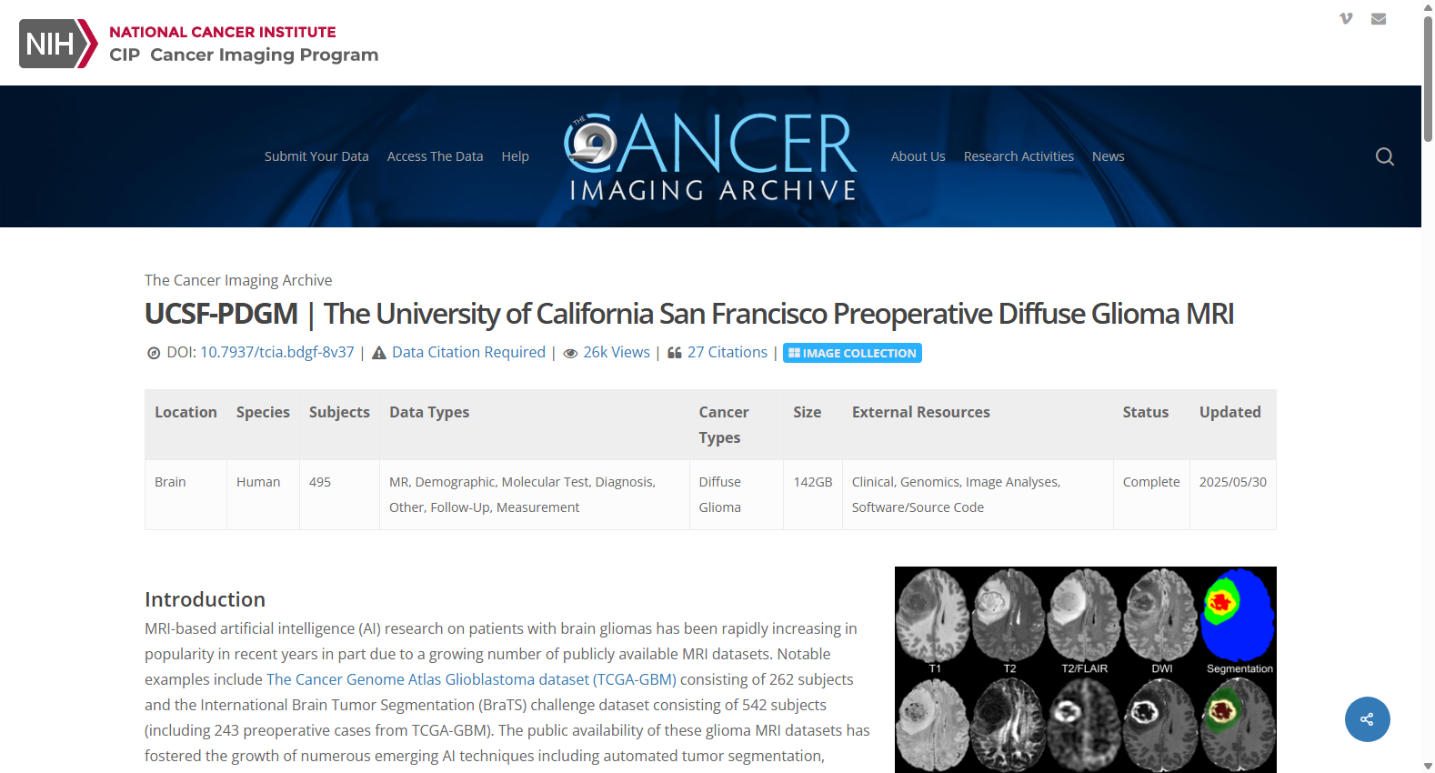UCSF-PDGM