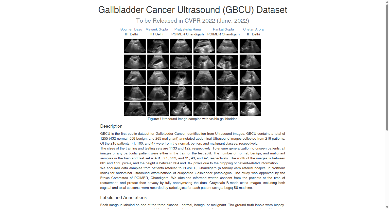 GBCU