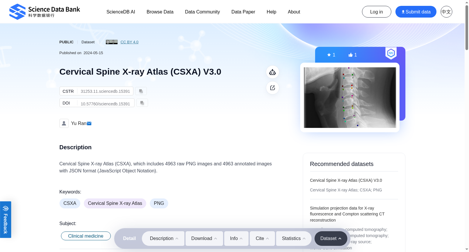 Cervical Spine X-ray Atlas (CSXA) V3.0 数据集图片