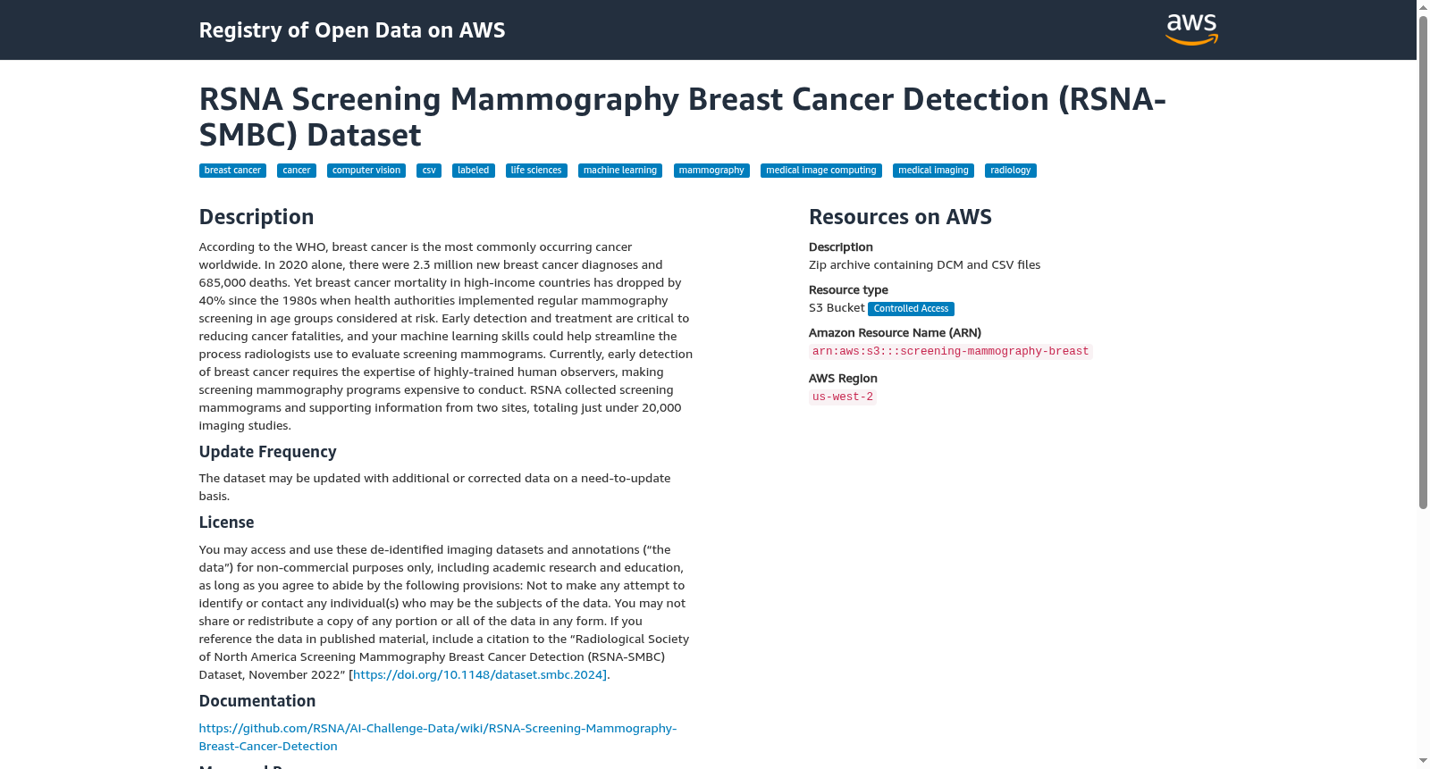 RSNA Screening Mammography Breast Cancer Detection (RSNA-SMBC) Dataset 数据集图片