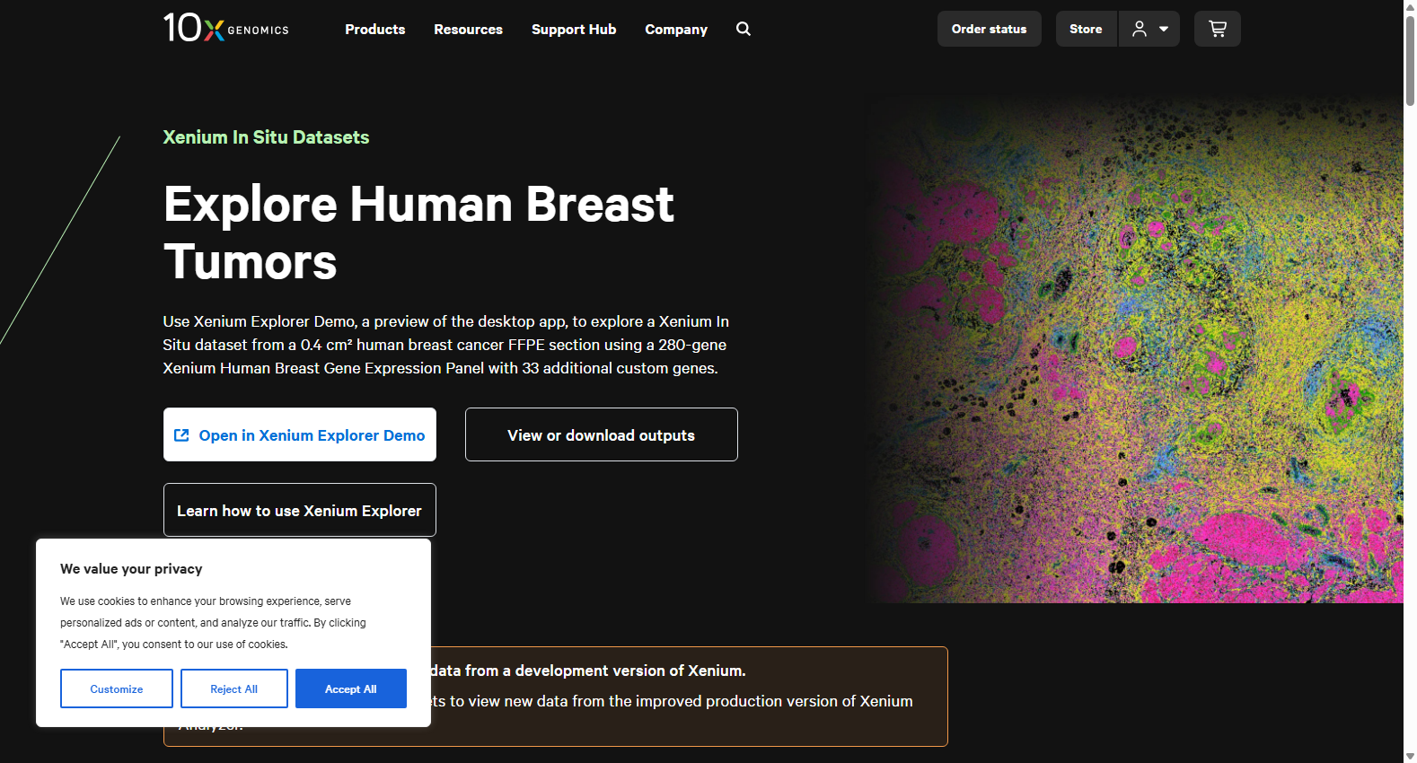 Human Breast Xenium Dataset