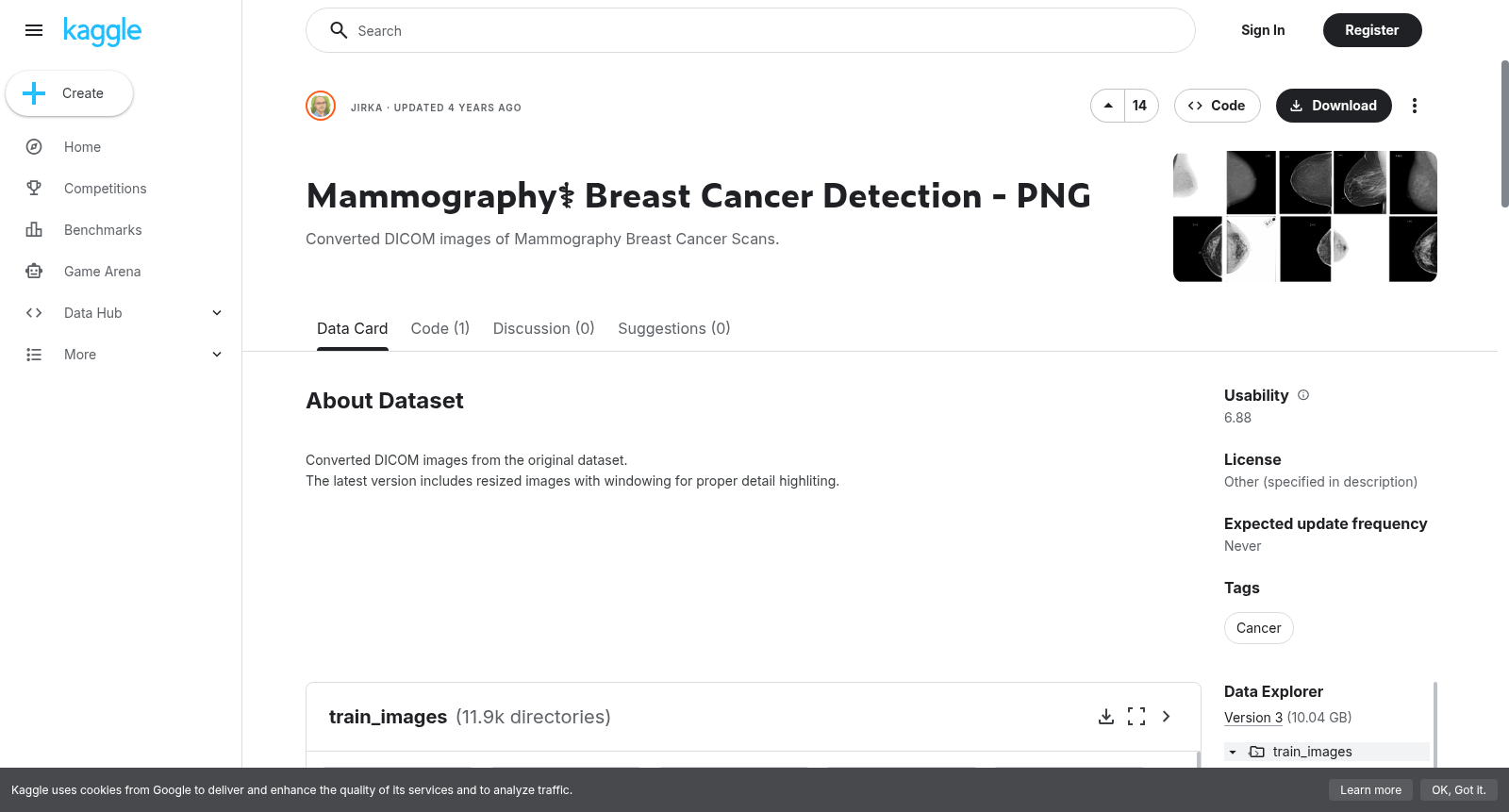 Mammography⚕️ Breast Cancer Detection - PNG 数据集图片