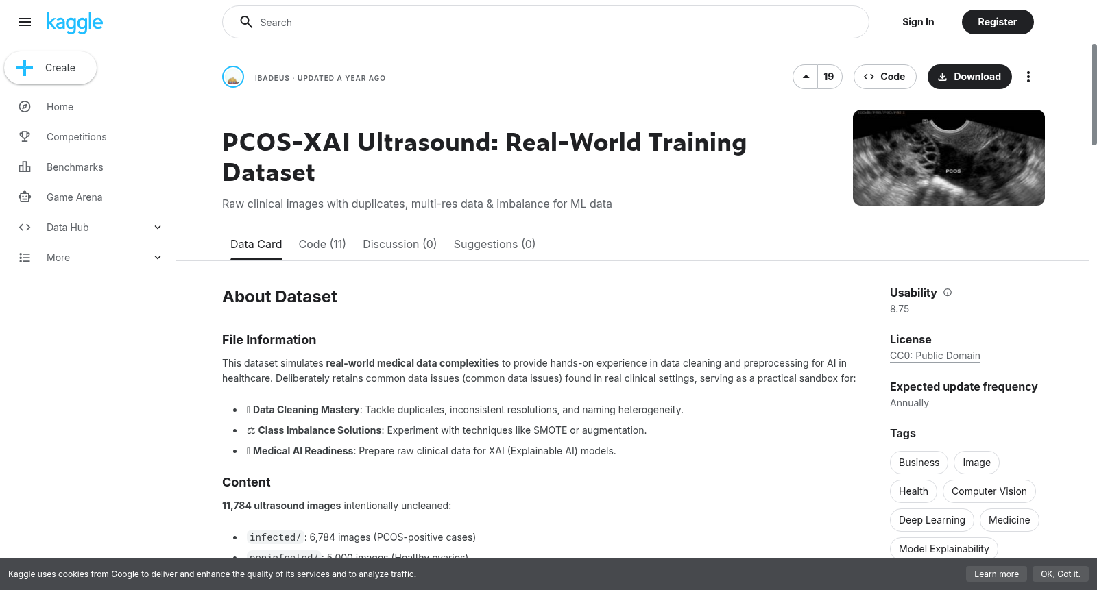 PCOS-XAI Ultrasound: Real-World Training Dataset 数据集图片