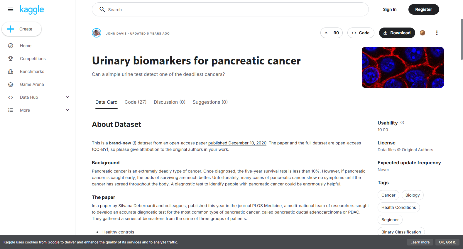 Urinary Biomarkers for Pancreatic Cancer