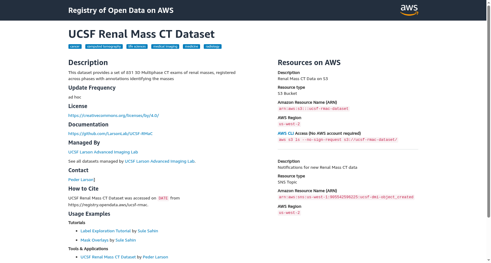 UCSF Renal Mass CT Dataset 数据集图片
