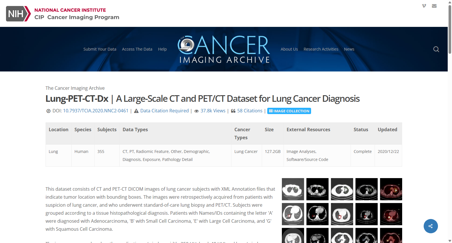 Lung-PET-CT-Dx