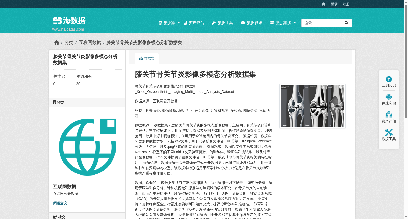 膝关节骨关节炎影像多模态分析数据集 数据集图片