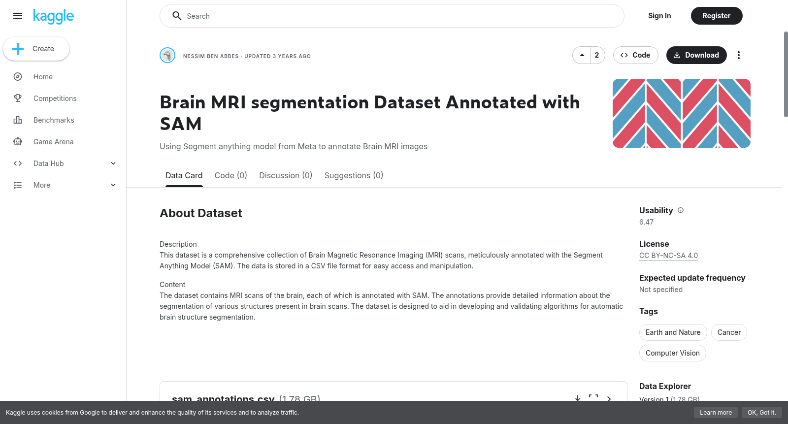 Brain MRI segmentation Dataset Annotated with SAM 数据集图片