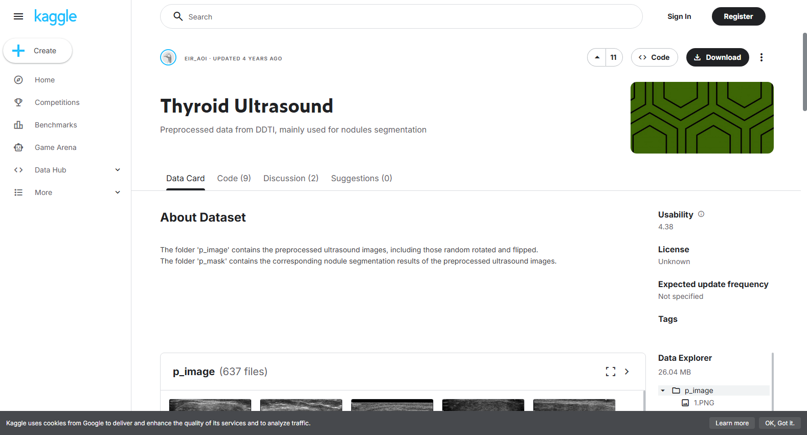 Thyroid Ultrasound / DDTI preprocessed dataset