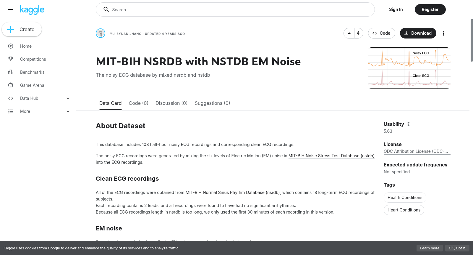 MIT-BIH NSRDB with NSTDB EM Noise 数据集图片