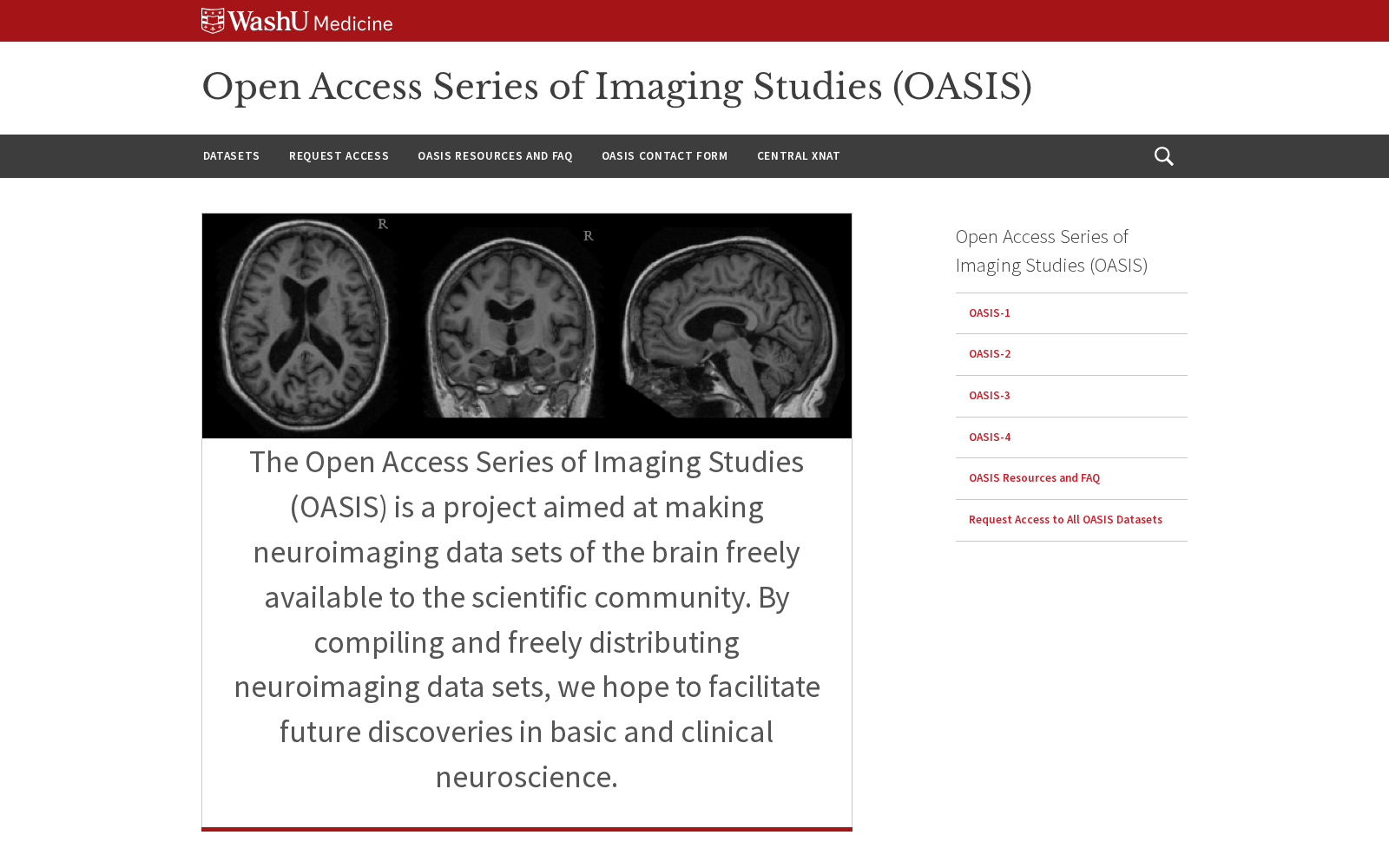 Open Access Series of Imaging Studies 数据集图片