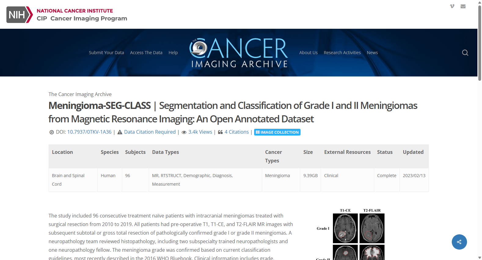 MENINGIOMA-SEG-CLASS