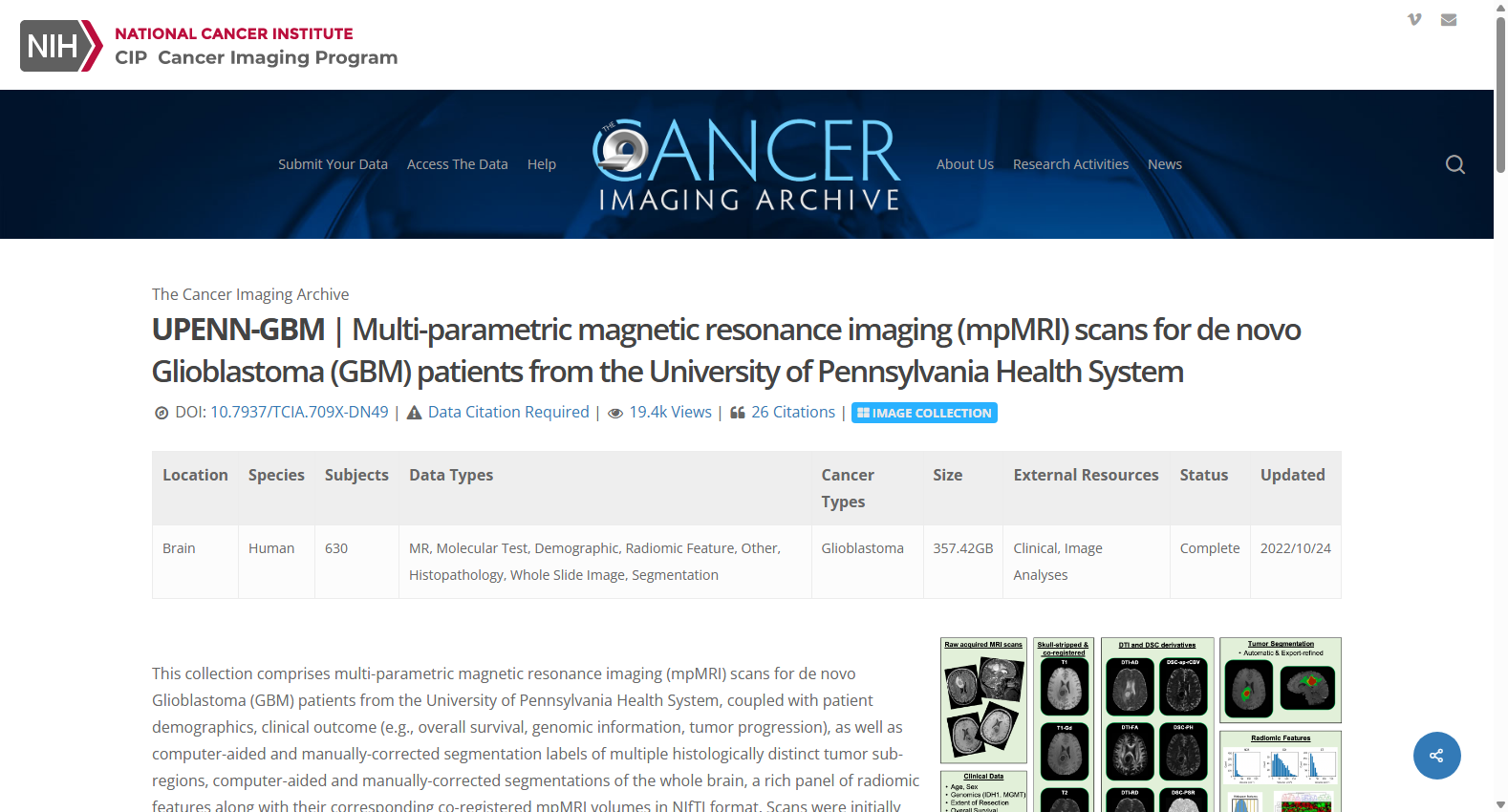 UPENN-GBM