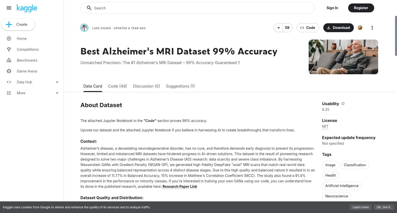 Best Alzheimer's MRI Dataset 99% Accuracy 数据集图片